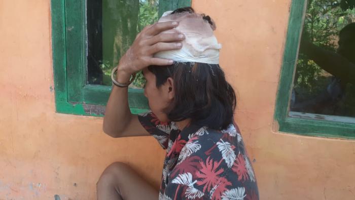 Mengaku Diserang Geng Motor, Pemuda Palabuhanratu Sukabumi Alami Luka Bacok di Kepala